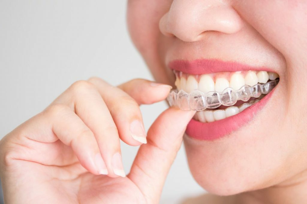 ortodonzia-invisibile-invisalign-como-1024x683